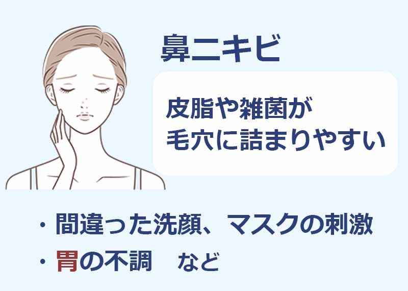 鼻ニキビ,皮脂や雑菌が毛穴に詰まりやすい,間違った洗顔,マスクの刺激,胃の不調など