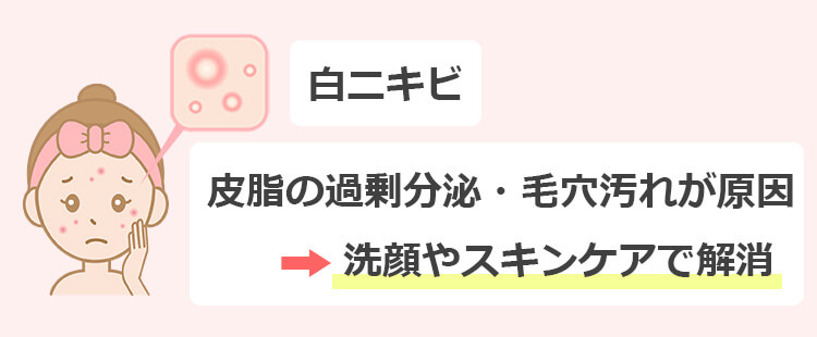 白ニキビを即効で治す方法