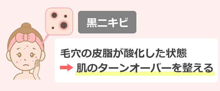 黒ニキビを即効で治す方法