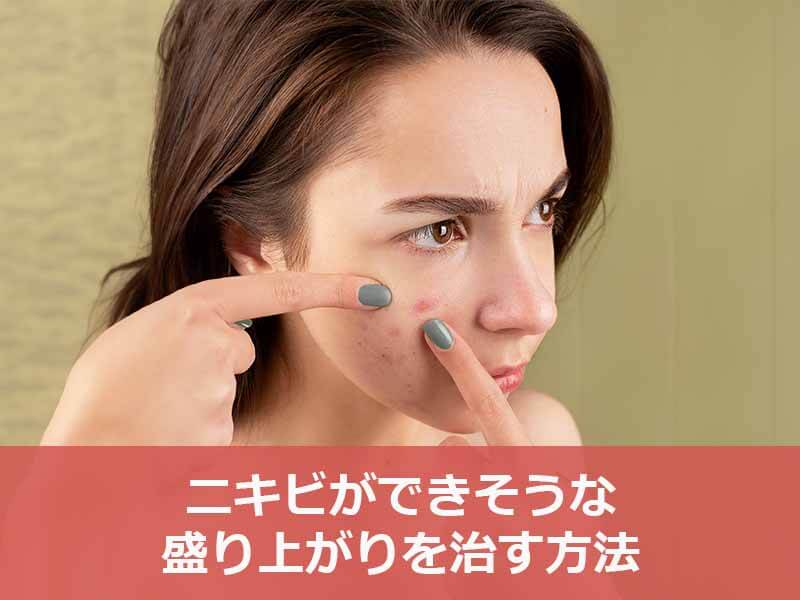 ニキビができそうな盛り上がりを治す方法