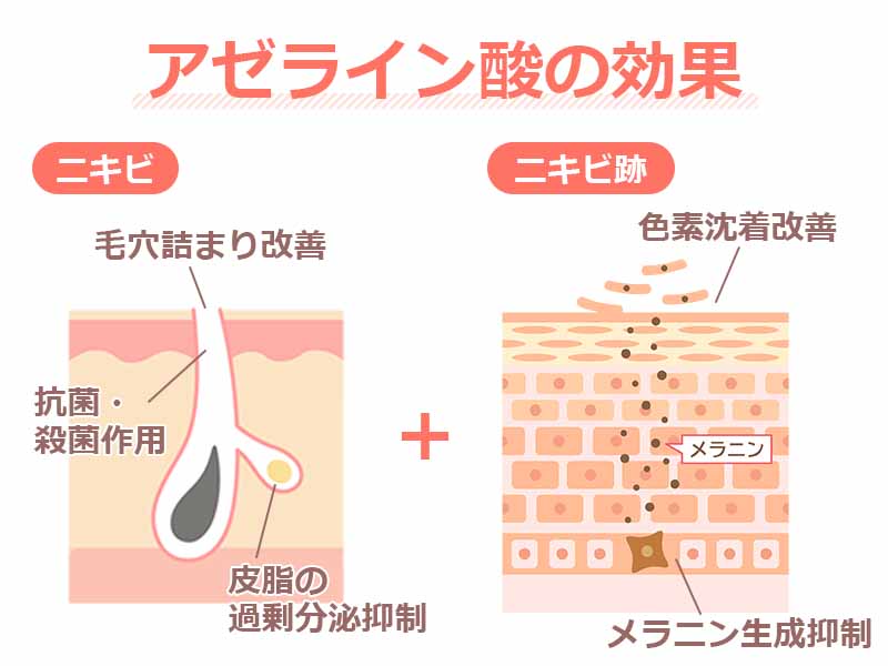 アゼライン酸の効果