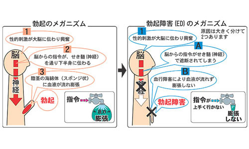 勃起のメカニズム