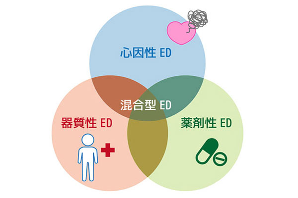 ED（勃起不全）の原因